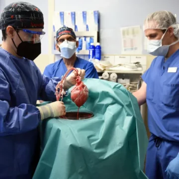 American who received a pig heart transplant has died after two months